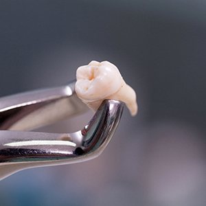A tooth that has been recently extracted